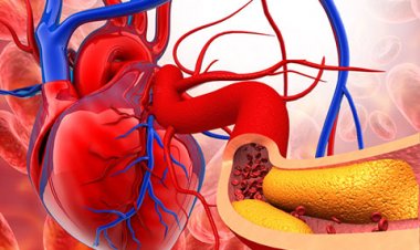 ކޮލެސްޓްރޯލް މަތިވެއްޖެނަމަ ކުރަންވީކީއް!